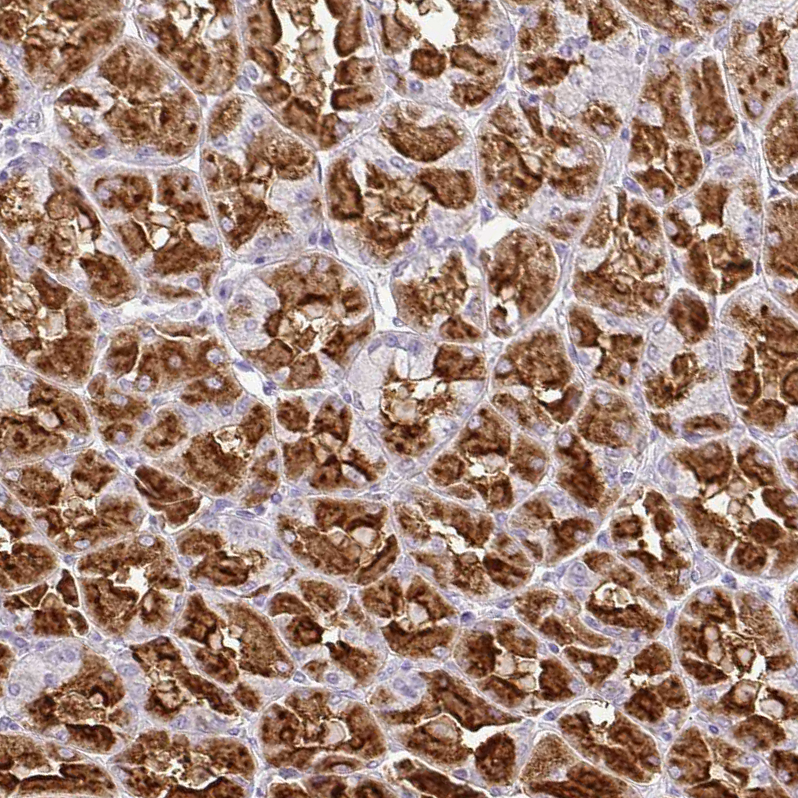 Atlas Antibodies Anti-CMPK1 Antibody