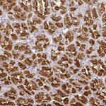 Atlas Antibodies Anti-CMPK1 Antibody