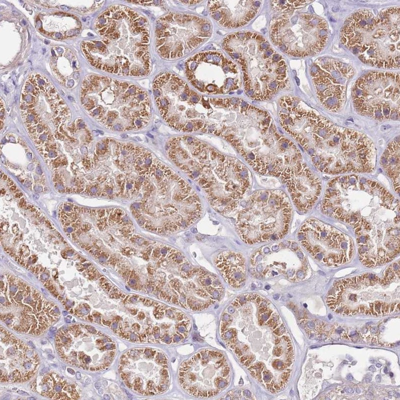 Atlas Antibodies Anti-CMKLR1 Antibody