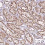 Atlas Antibodies Anti-CMKLR1 Antibody