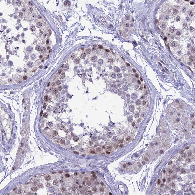 Atlas Antibodies Anti-CMSS1 Antibody