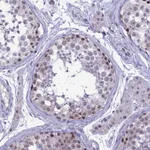 Atlas Antibodies Anti-CMSS1 Antibody