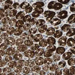 Atlas Antibodies Anti-CMC2 Antibody