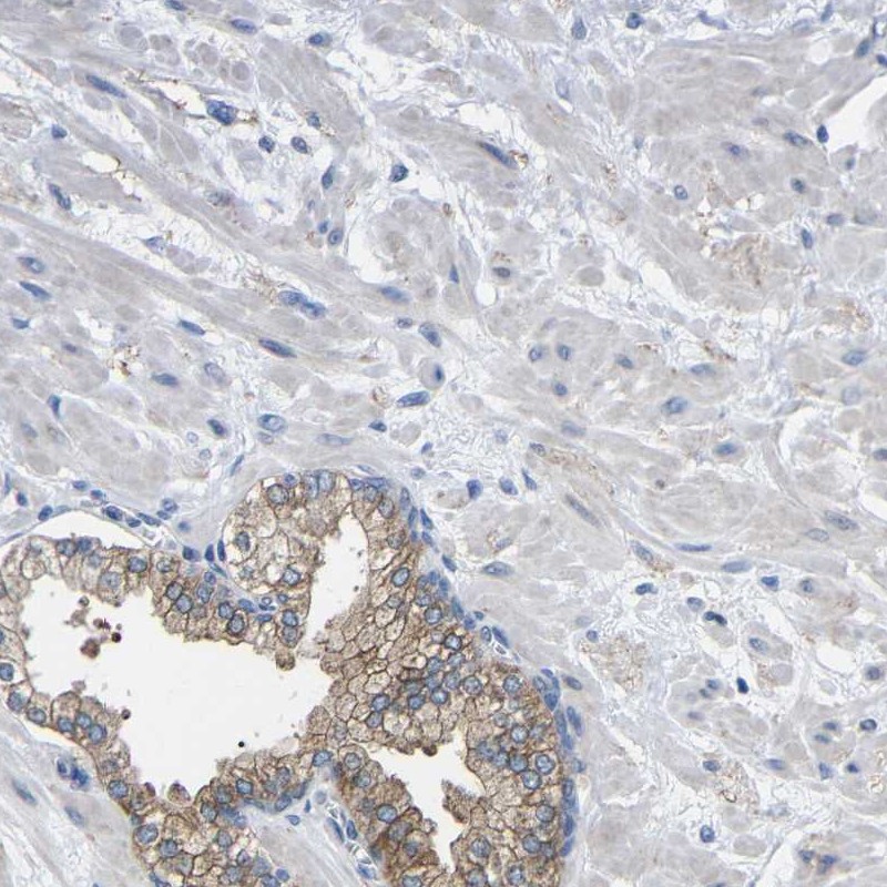 Atlas Antibodies Anti-CMTM1 Antibody