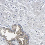 Atlas Antibodies Anti-CMTM1 Antibody