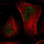 Atlas Antibodies Anti-CMTM3 Antibody