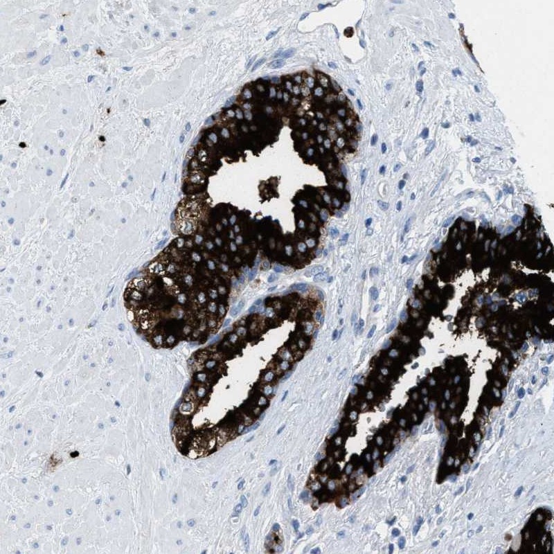 Atlas Antibodies Anti-CMTM1 Antibody
