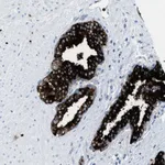 Atlas Antibodies Anti-CMTM1 Antibody