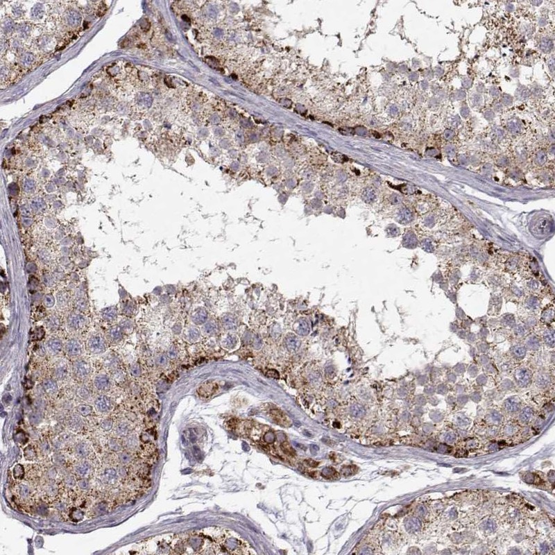 Atlas Antibodies Anti-CMTM3 Antibody