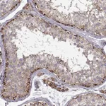 Atlas Antibodies Anti-CMTM3 Antibody