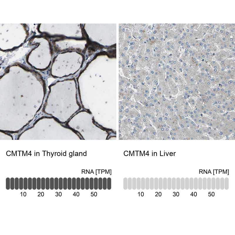 Atlas Antibodies Anti-CMTM4 Antibody
