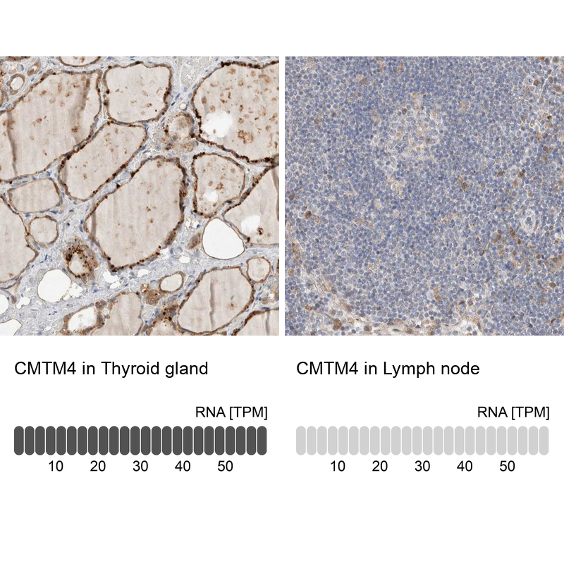 Atlas Antibodies Anti-CMTM4 Antibody