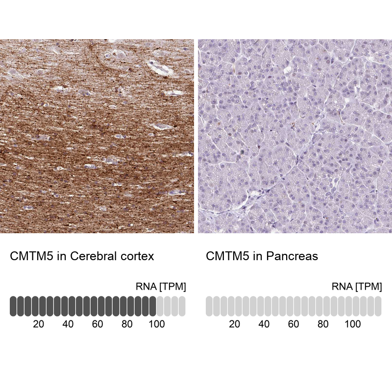 Atlas Antibodies Anti-CMTM5 Antibody