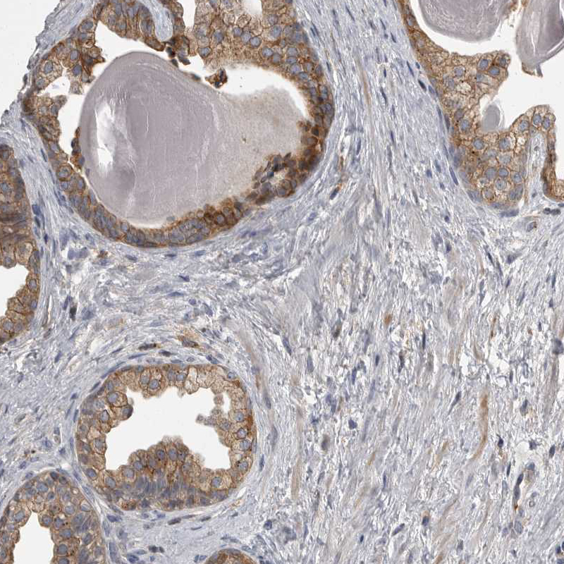 Atlas Antibodies Anti-CMTM6 Antibody
