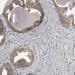 Atlas Antibodies Anti-CMTM6 Antibody