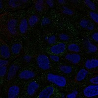 Atlas Antibodies Anti-CMTM6 Antibody