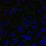 Atlas Antibodies Anti-CMTM6 Antibody
