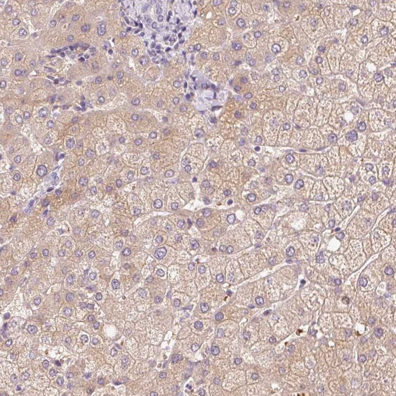 Atlas Antibodies Anti-CMTM8 Antibody