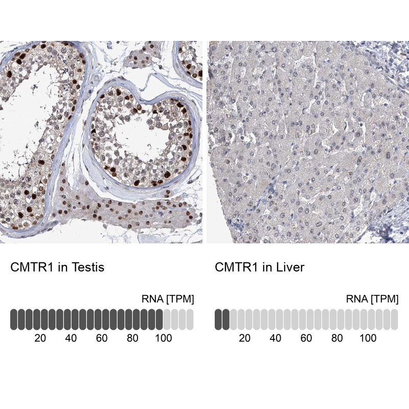 Atlas Antibodies Anti-CMTR1 Antibody