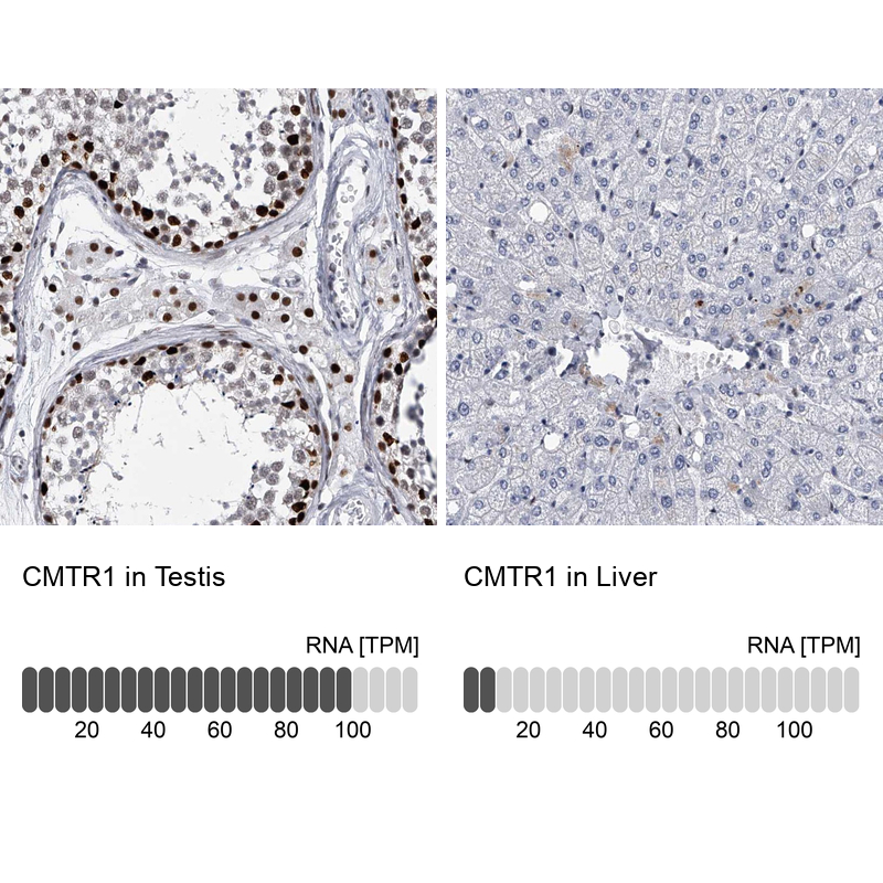 Atlas Antibodies Anti-CMTR1 Antibody