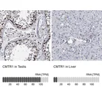 Atlas Antibodies Anti-CMTR1 Antibody