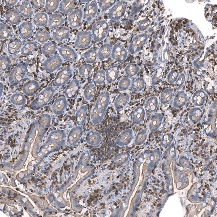 Atlas Antibodies Anti-CMTR2 Antibody