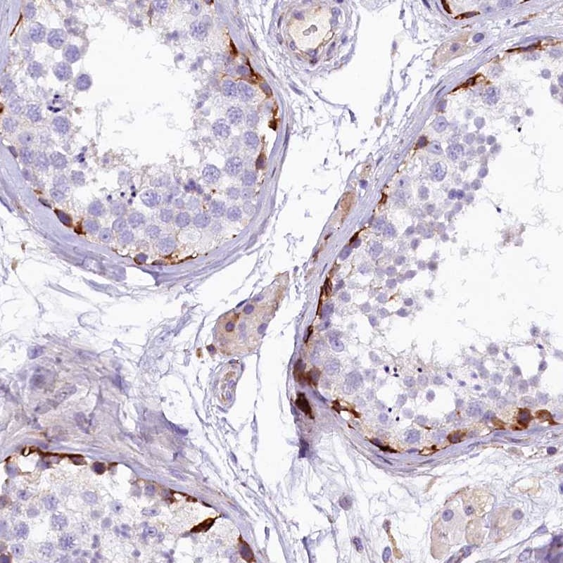 Atlas Antibodies Anti-CMTR2 Antibody