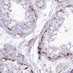 Atlas Antibodies Anti-CMTR2 Antibody