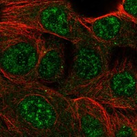 Atlas Antibodies Anti-CMYA5 Antibody