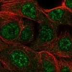 Atlas Antibodies Anti-CMYA5 Antibody