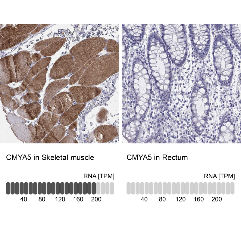 Atlas Antibodies Anti-CMYA5 Antibody