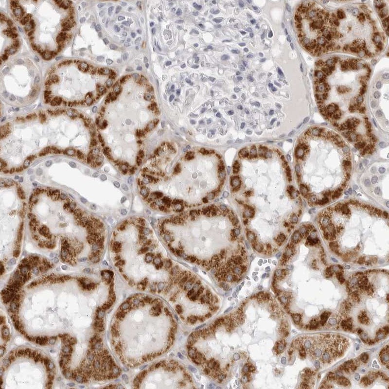 Atlas Antibodies Anti-CNBD1 Antibody