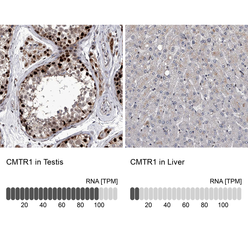 Atlas Antibodies Anti-CMTR1 Antibody