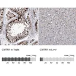 Atlas Antibodies Anti-CMTR1 Antibody