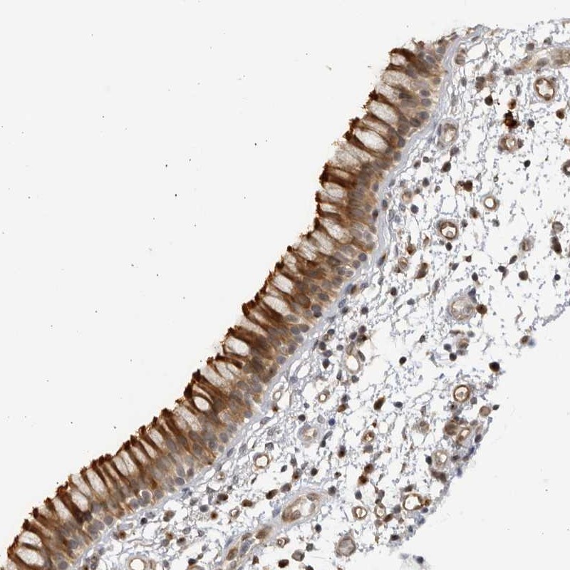 Atlas Antibodies Anti-CNBD1 Antibody