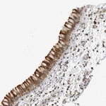 Atlas Antibodies Anti-CNBD1 Antibody
