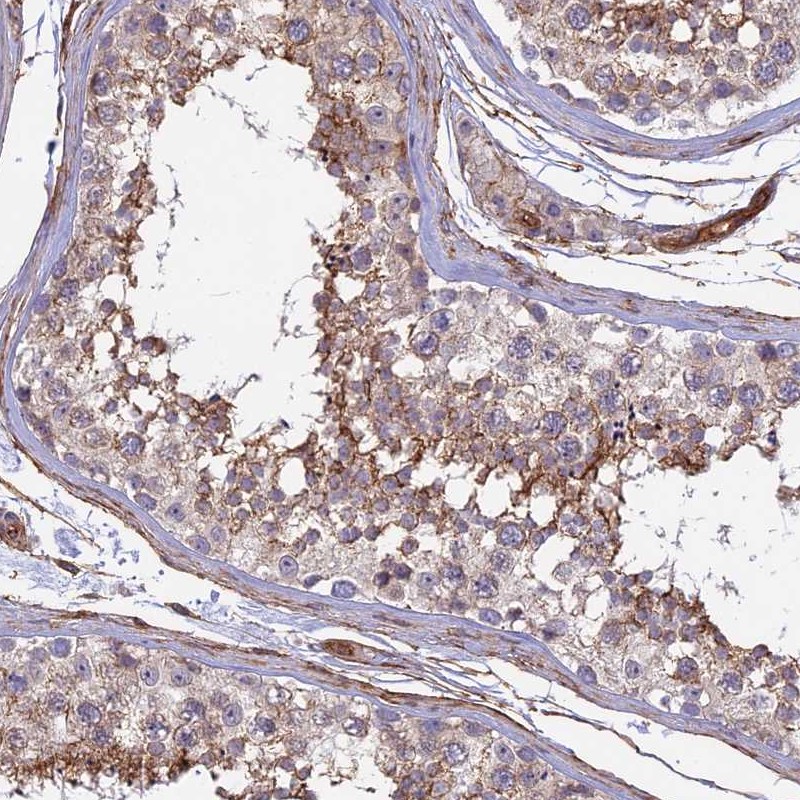 Atlas Antibodies Anti-CNBD2 Antibody