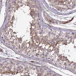 Atlas Antibodies Anti-CNBD2 Antibody