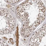 Atlas Antibodies Anti-CNBD1 Antibody