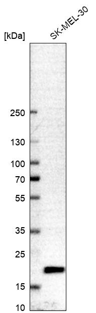 Atlas Antibodies Anti-CNBP Antibody