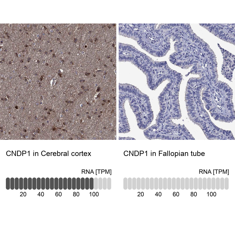 Atlas Antibodies Anti-CNDP1 Antibody