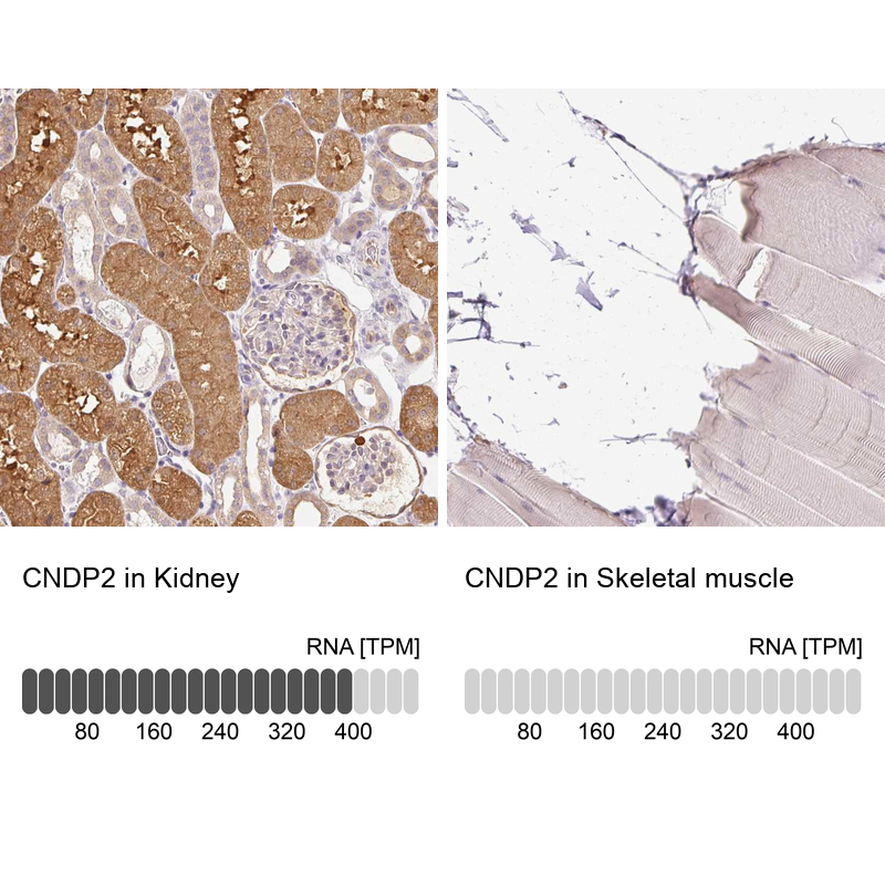 Atlas Antibodies Anti-CNDP2 Antibody