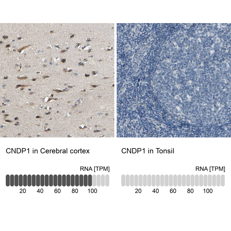 Atlas Antibodies Anti-CNDP1 Antibody
