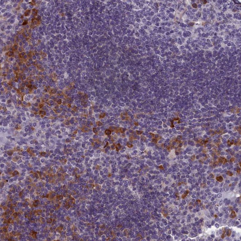 Atlas Antibodies Anti-CNEP1R1 Antibody