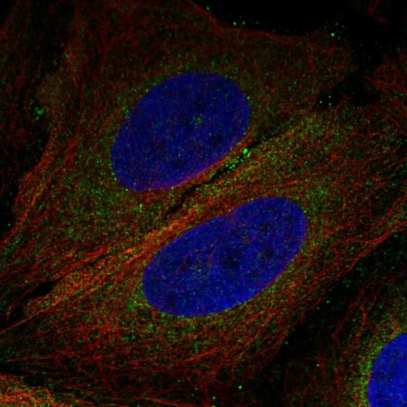 Atlas Antibodies Anti-CNEP1R1 Antibody