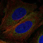 Atlas Antibodies Anti-CNEP1R1 Antibody