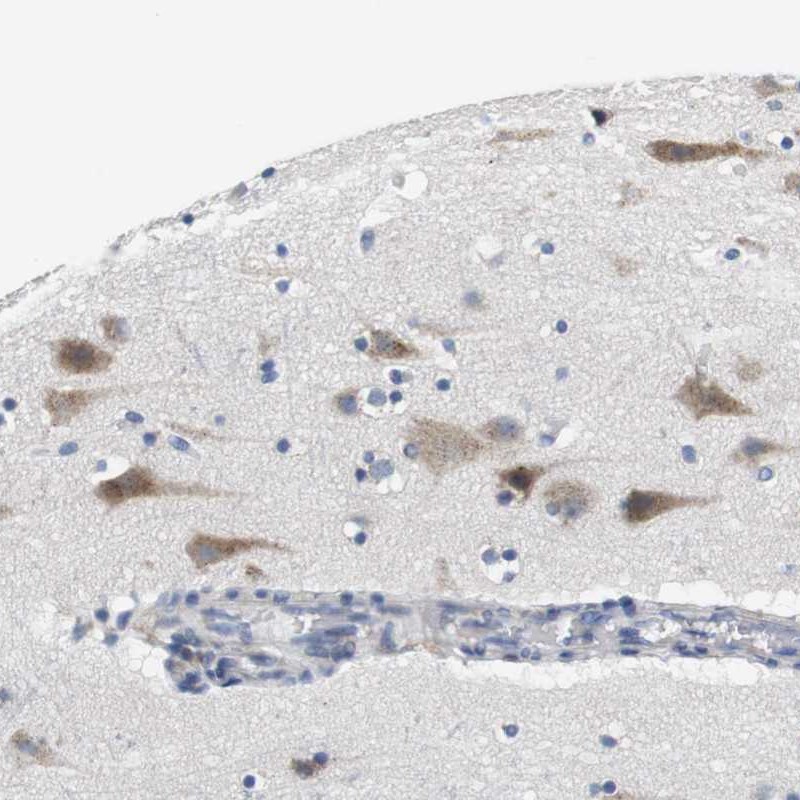 Atlas Antibodies Anti-CNGA2 Antibody