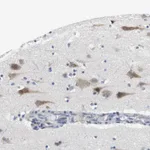 Atlas Antibodies Anti-CNGA2 Antibody