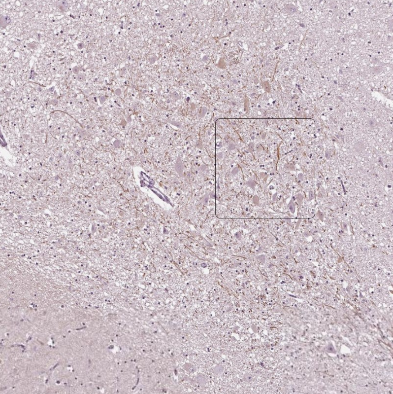 Atlas Antibodies Anti-CNGA3 Antibody