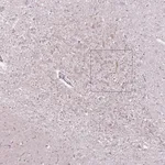 Atlas Antibodies Anti-CNGA3 Antibody